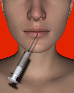 what to do and avoid after a dermal filler treatment